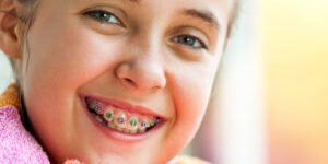 child-braces-300×300